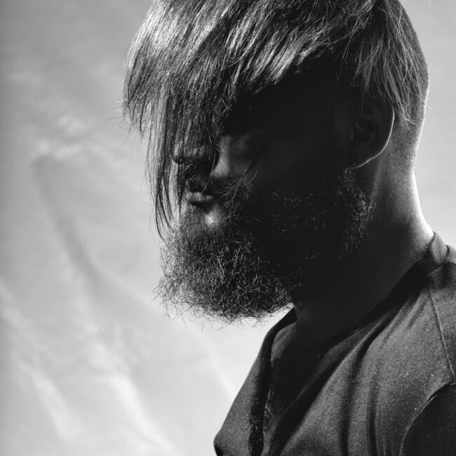 Диагностика на скалп