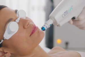 clearlift-4d